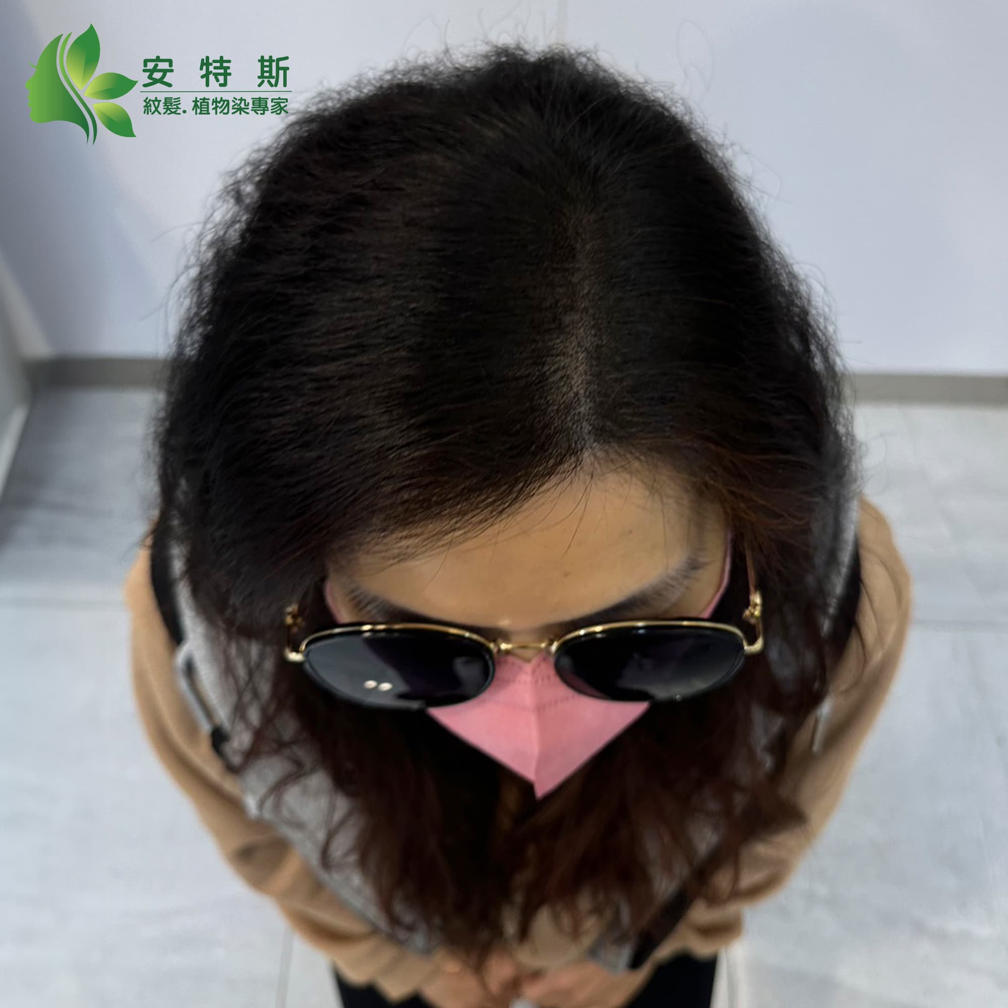 告別頭髮分線煩腦