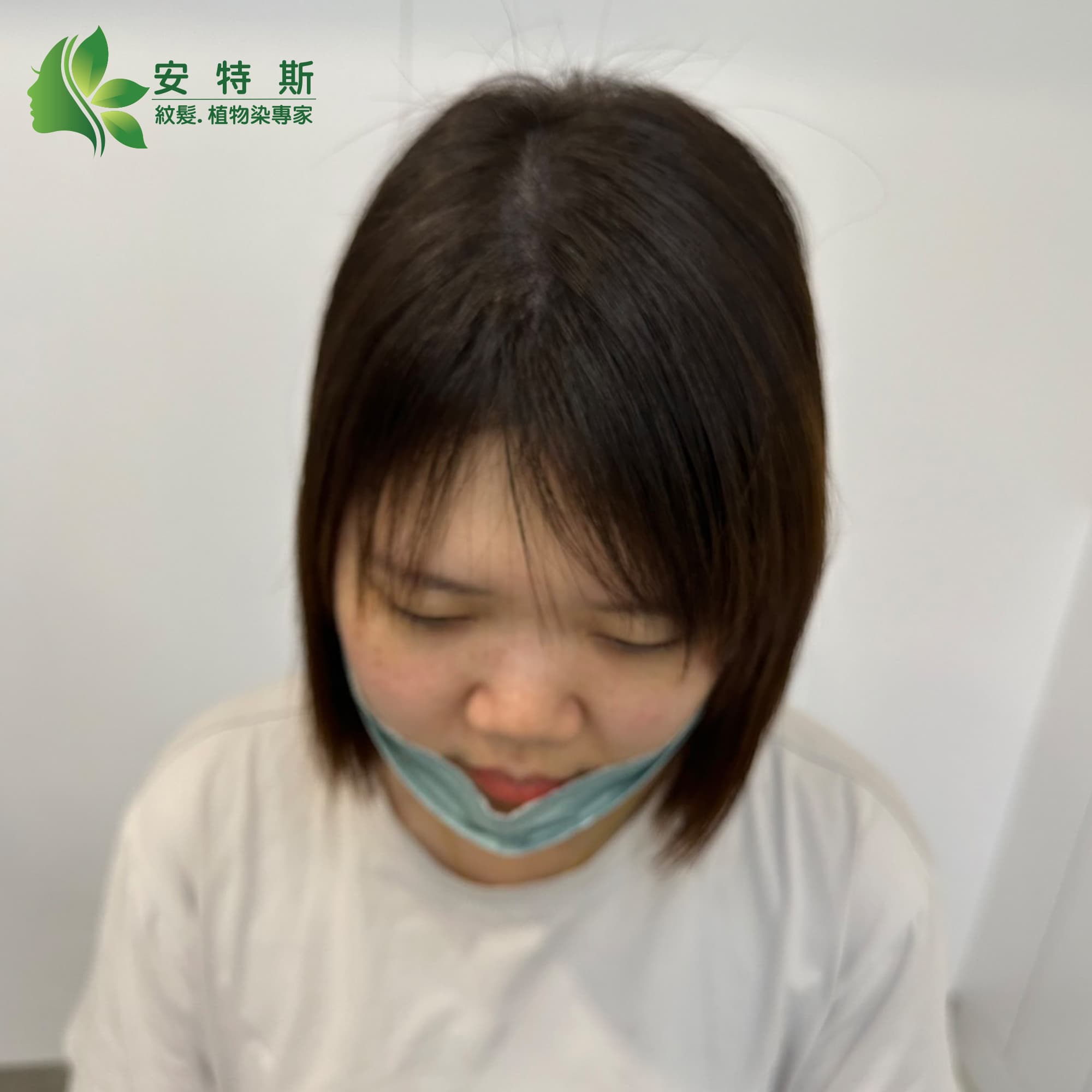 後腦勺的髮線奇蹟轉變